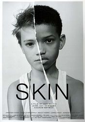 Poster Skin