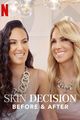 Film - Skin Decision: Before and After
