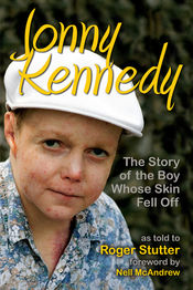 Poster The Boy Whose Skin Fell Off