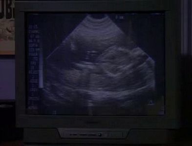 The One with the Sonogram at the End